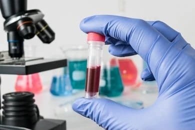 Cancer treatment has significantly advanced with the introduction of targeted therapies like Ibruxen 140 mg (Ibrutinib). This medication is widely used to treat different types of blood cancer, including chronic lymphocytic leukemia (CLL), mantle cell lymphoma (MCL), and Waldenström’s macroglobulinemia (WM).