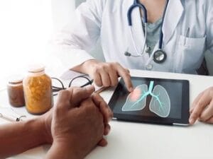 Osimert 80 mg (Osimertinib) – A breakthrough therapy for advanced lung cancer, improving survival rates for Armenian patients.